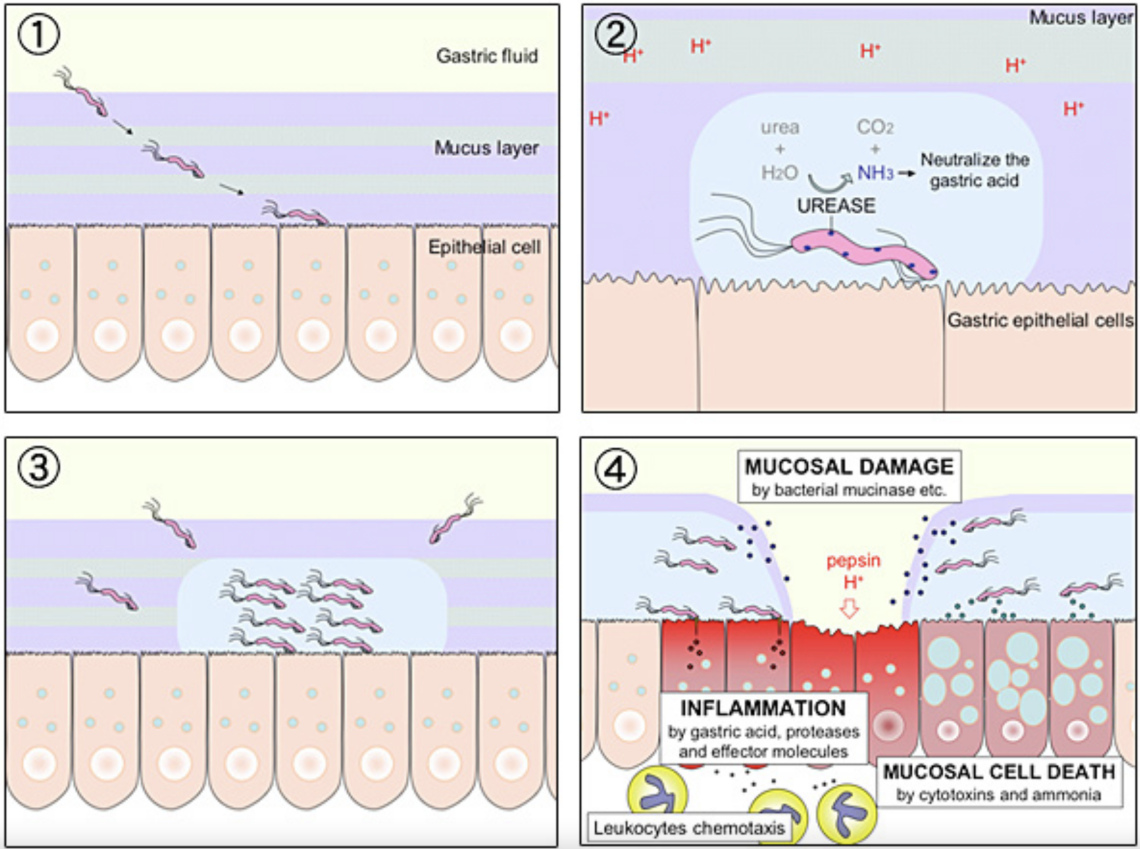 H. Pylori diagram