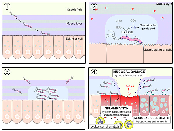 hpylori infection